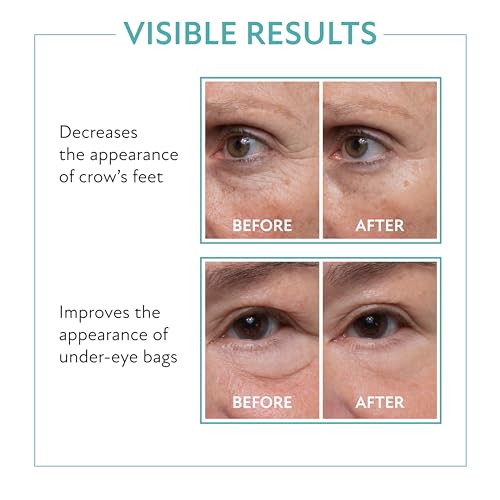 Eye Serum Under Eye Cream Tightening Serum 0.33 fl oz T689